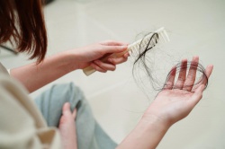 Выпадение волос: причины и факторы